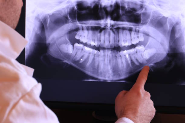 Best Urgent Dental Care for Toothache in Old Stine, CA