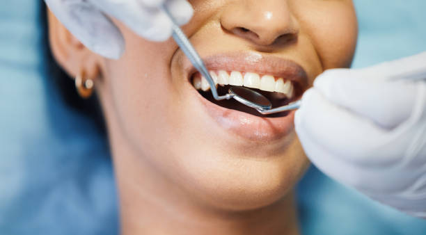 Best Mobile Emergency Dentist in Old Stine, CA